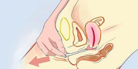 Removendo um preservativo desalojado do seu corpo