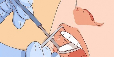 Tratando um dente solto