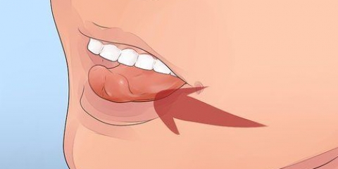 Perder um dente solto sem puxá-lo