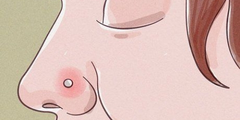 Tratando um piercing no nariz inflamado