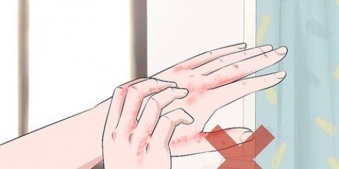 Reconhecendo uma infecção fúngica