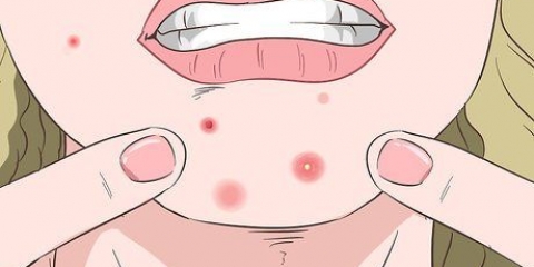 Reconhecendo uma infecção estafilocócica