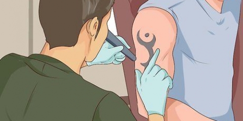 Remover uma tatuagem