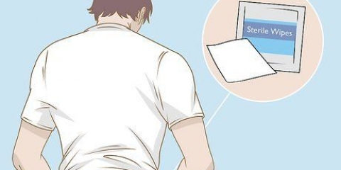 Lendo uma tira de teste durante um exame de urina