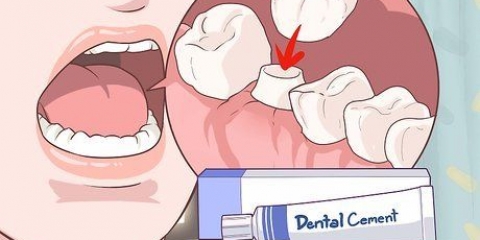Reparando uma coroa dentária perdida