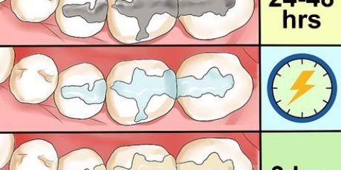 Cuidar de uma obturação em um dente ou molar