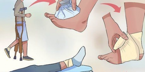 Primeiros socorros para uma entorse