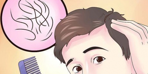 Descubra se você está ficando careca