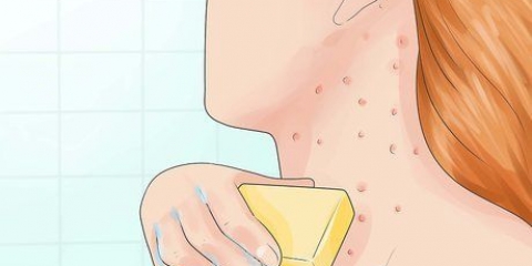 Tratamento da foliculite