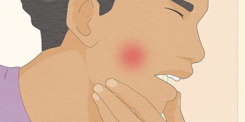 Prevenir e curar cáries em seus dentes