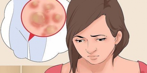 Tratamento de verrugas genitais em mulheres