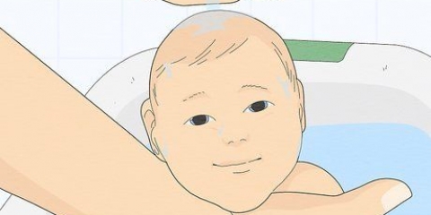 Tratamento de erupções de calor em bebês