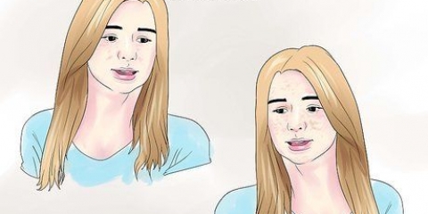 Tratamento da hiperpigmentação