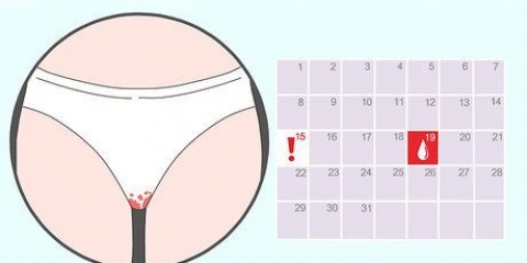 Reconhecendo o sangramento de implantação