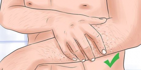 Raspe os braços