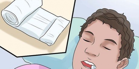 Limpar os dentes depois de extrair os dentes do siso