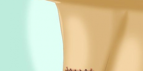 Cuidando da sua incisão após a cirurgia da tireoide
