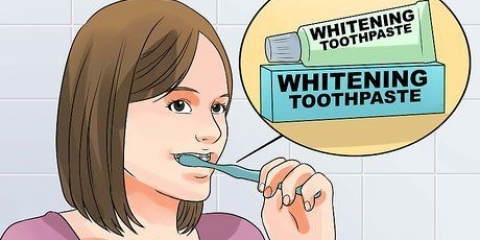 Clarear os dentes quando você usa aparelho