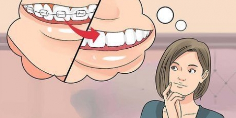 Preparando-se para o dia em que você colocar o aparelho