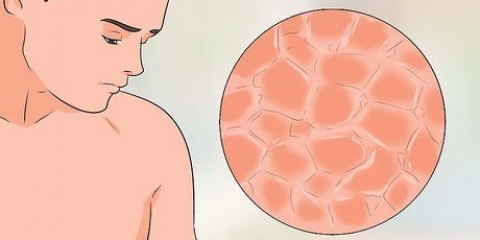 Tratando os seios com coceira