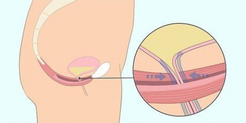 Faça exercícios de kegel