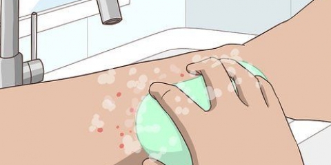Tratamento de picadas de mosquito