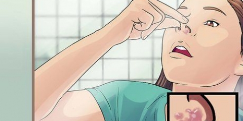 Tratamento de herpes labial no nariz