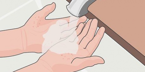 Prevenção de cicatrizes