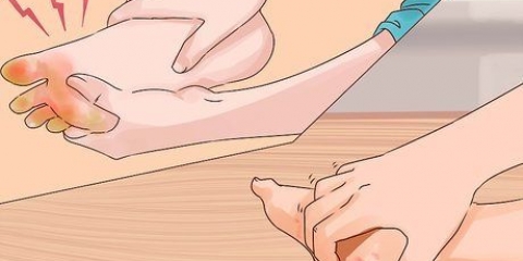 Tratamento de pés de trincheira