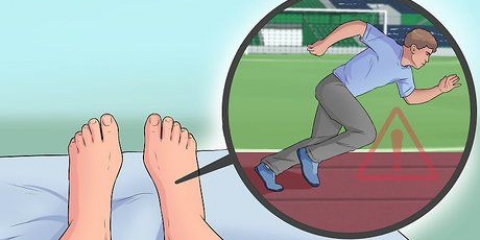 Tratamento da fascite plantar