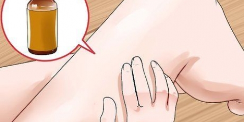 Tratamento da micose: pode naturalmente?