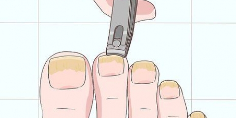 Tratamento de unhas fúngicas