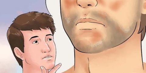 Tratamento do eczema seborreico no rosto