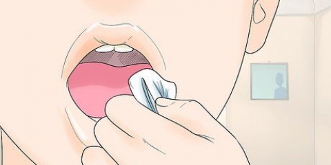 Dormir após a remoção do dente do siso
