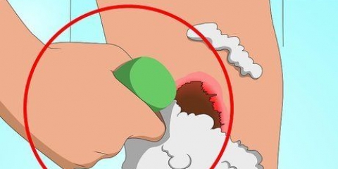 Livre-se das crostas de acne rapidamente