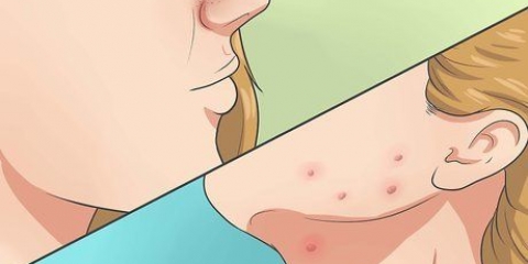 Livre-se da acne de forma rápida e natural
