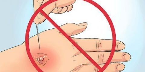 Curar furúnculos: pode ser feito naturalmente?