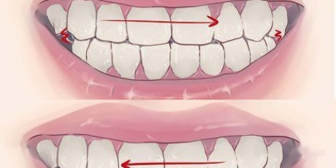 Pare de ranger os dentes enquanto dorme