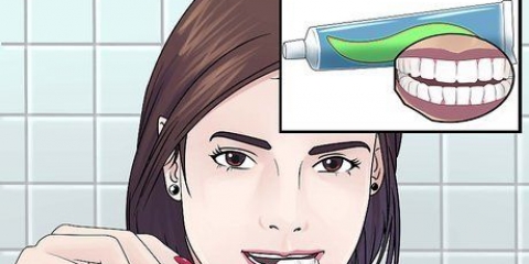 Clareamento dental com peróxido de hidrogênio