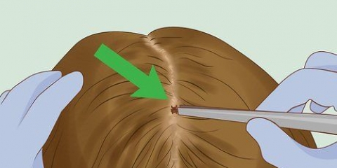Tirar carrapatos do seu cabelo
