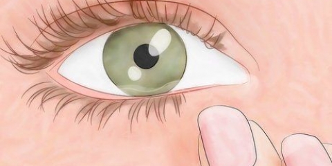 Descubra se você tem ácaros nos olhos