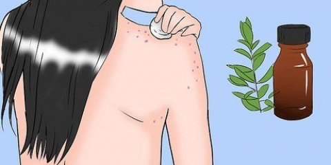 Livre-se da acne em seu corpo