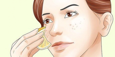 Livrar-se de manchas marrons: pode ser feito com remédios caseiros?