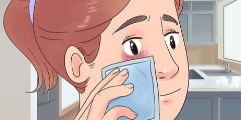 Livre-se de um olho roxo