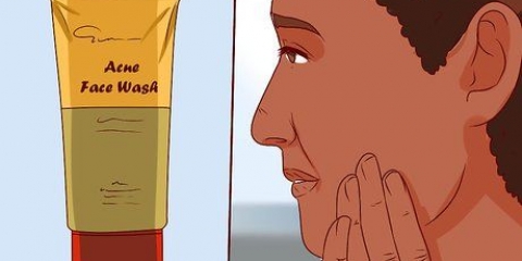 Livre-se de uma espinha com gel de aloe vera