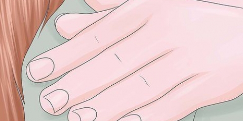 Livre-se das manchas brancas nas unhas