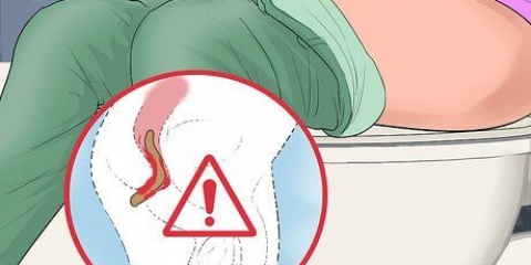 Determinando se você sofre de hemorróidas internas