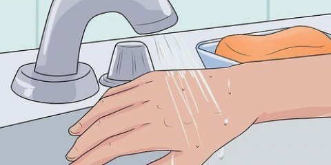 Tratamento de picadas de pulgas