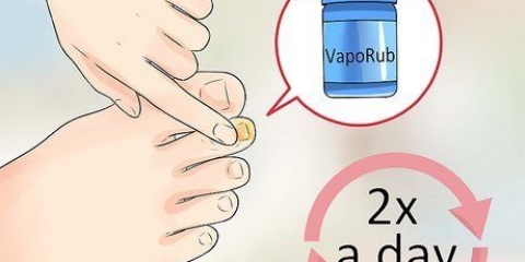 Tratamento do pé de atleta: pode ser feito com produtos de autocuidado?