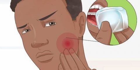 Saiba quando suas obturações dentárias precisam ser substituídas